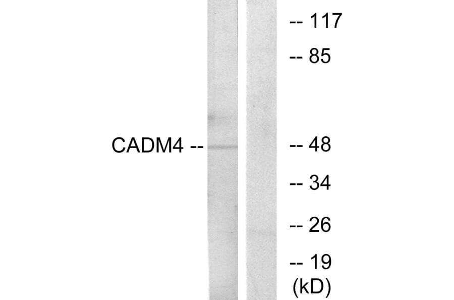 Western Blot - Anti-CADM4 Antibody (C12111) - Antibodies.com