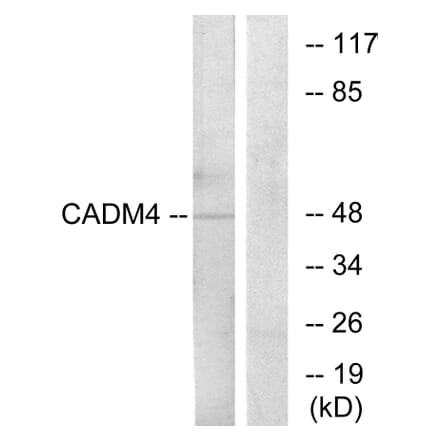 Western Blot - Anti-CADM4 Antibody (C12111) - Antibodies.com