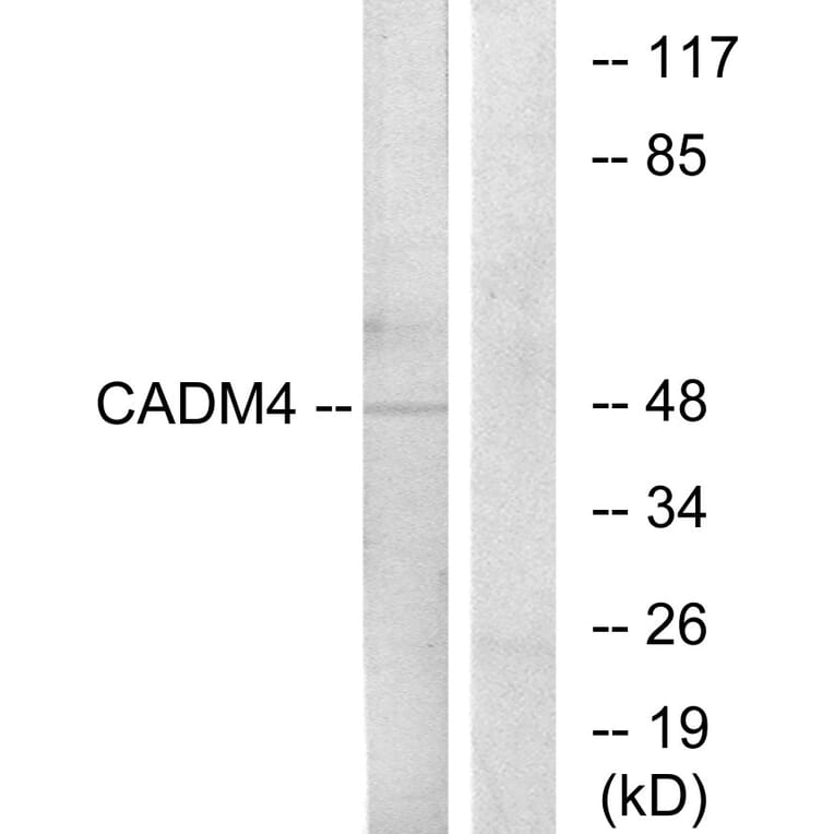 Western Blot - Anti-CADM4 Antibody (C12111) - Antibodies.com