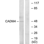 Western Blot - Anti-CADM4 Antibody (C12111) - Antibodies.com