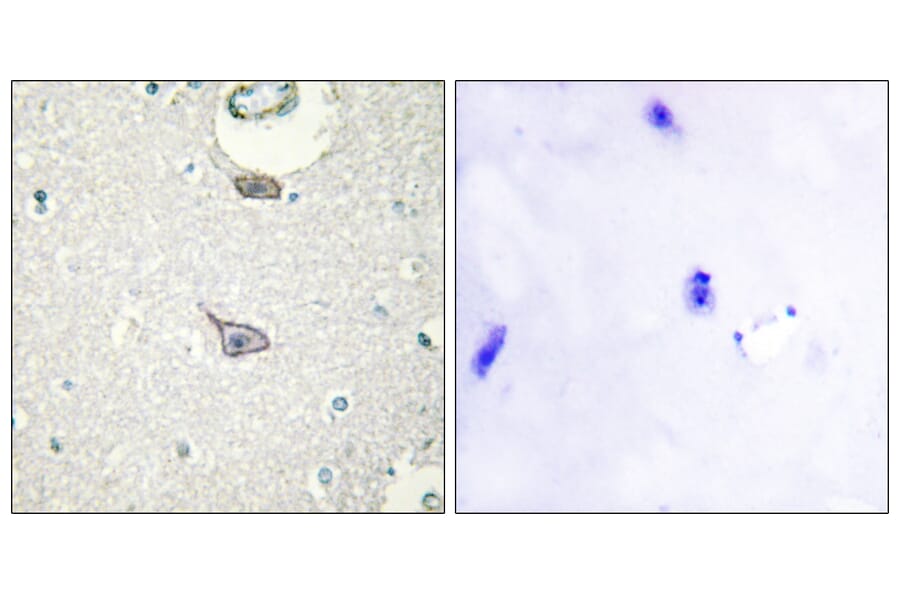 Immunohistochemistry - Anti-CADM4 Antibody (C12111) - Antibodies.com