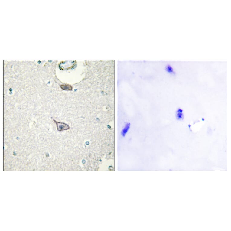 Immunohistochemistry - Anti-CADM4 Antibody (C12111) - Antibodies.com