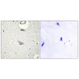 Immunohistochemistry - Anti-CADM4 Antibody (C12111) - Antibodies.com
