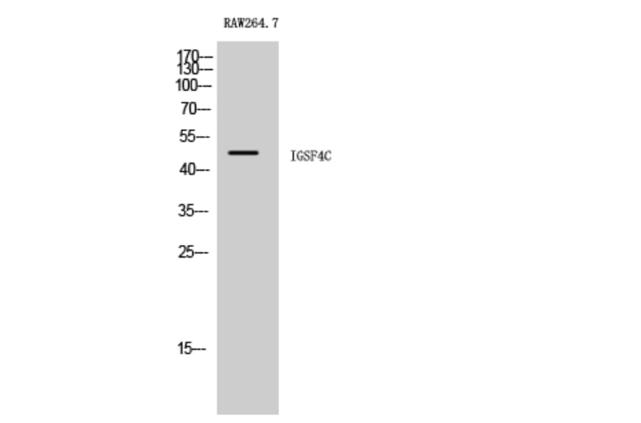 Western Blot - Anti-CADM4 Antibody (C12111) - Antibodies.com