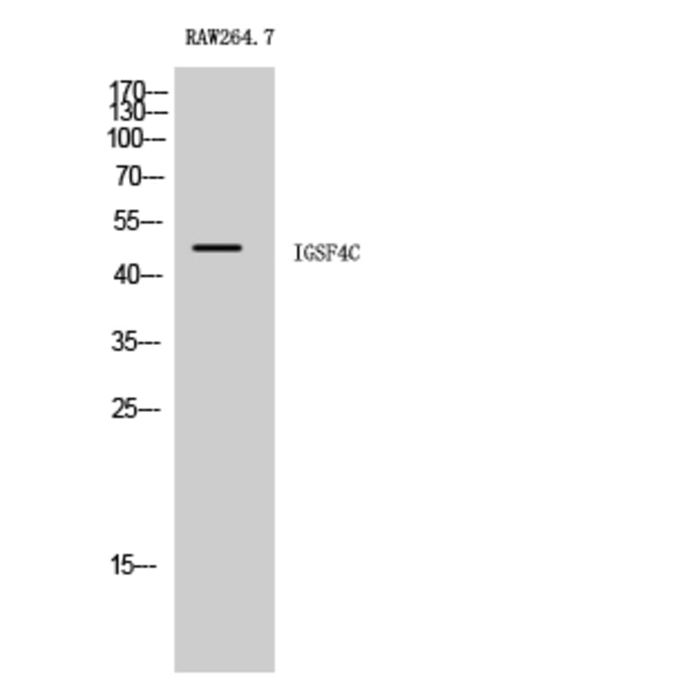 Western Blot - Anti-CADM4 Antibody (C12111) - Antibodies.com