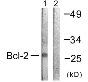 Western Blot - Anti-BCL-2 Antibody (B0774) - Antibodies.com