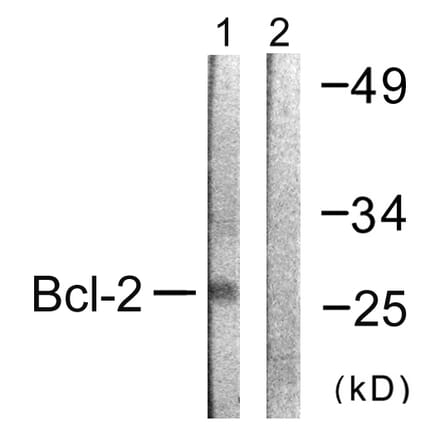Western Blot - Anti-BCL-2 Antibody (B0774) - Antibodies.com