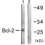 Western Blot - Anti-BCL-2 Antibody (B0774) - Antibodies.com