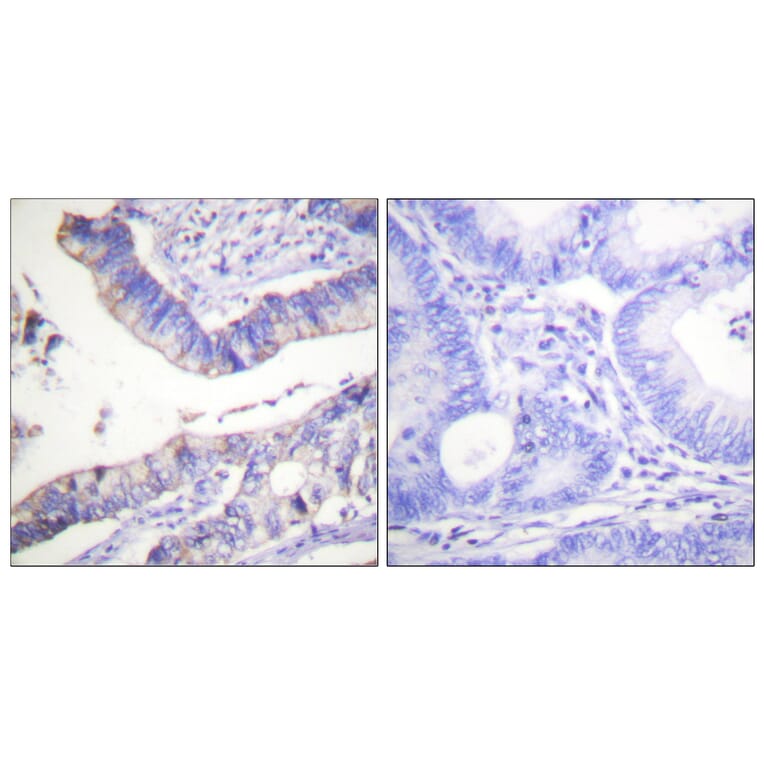 Immunohistochemistry - Anti-BCL-2 Antibody (B0774) - Antibodies.com