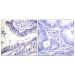 Immunohistochemistry - Anti-BCL-2 Antibody (B0774) - Antibodies.com