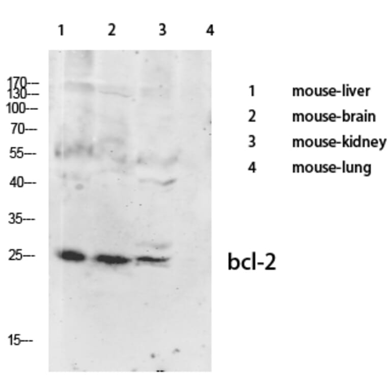 Western Blot - Anti-BCL-2 Antibody (B0774) - Antibodies.com