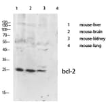 Western Blot - Anti-BCL-2 Antibody (B0774) - Antibodies.com