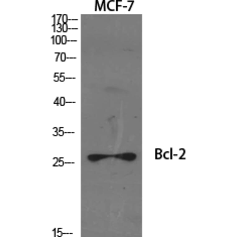 Western Blot - Anti-BCL-2 Antibody (B0774) - Antibodies.com