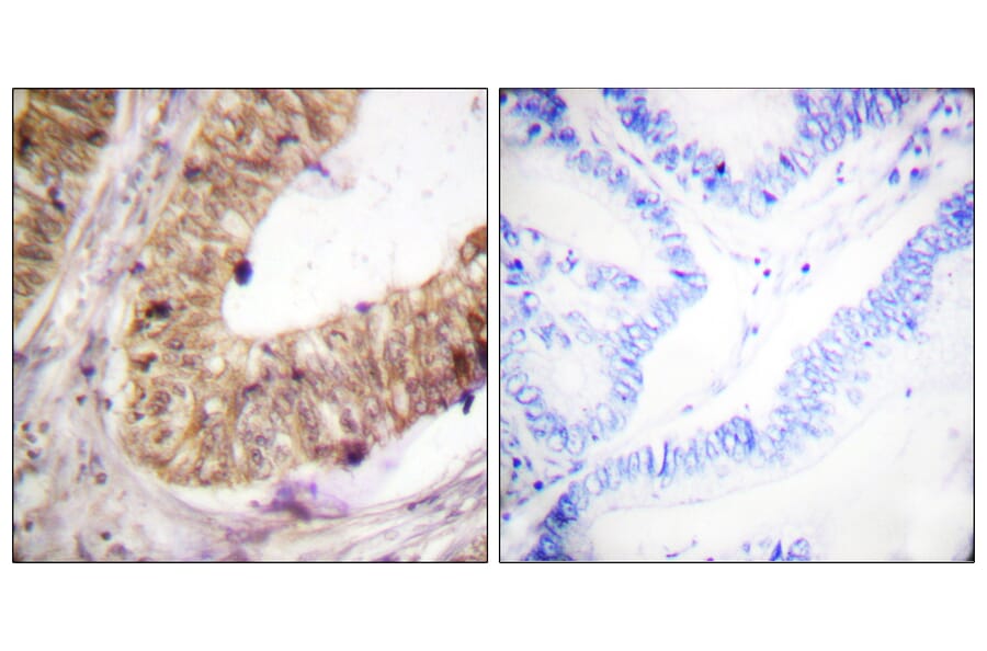 Immunohistochemistry - Anti-ATRIP Antibody (B0772) - Antibodies.com