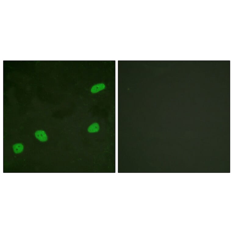 Immunofluorescence - Anti-ATRIP Antibody (B0772) - Antibodies.com
