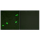 Immunofluorescence - Anti-ATRIP Antibody (B0772) - Antibodies.com