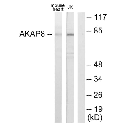 Western Blot - Anti-AKAP8 Antibody (C10121) - Antibodies.com