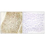 Immunohistochemistry - Anti-AKAP8 Antibody (C10121) - Antibodies.com