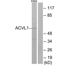 Western Blot - Anti-ACVL1 Antibody (C10579) - Antibodies.com