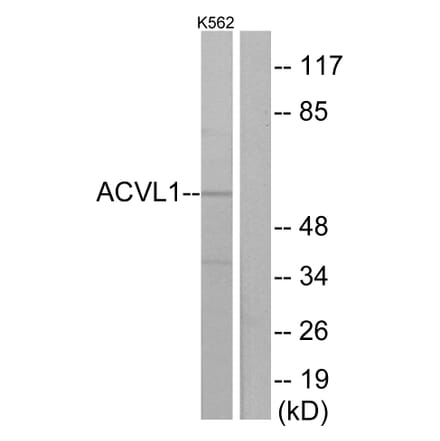 Western Blot - Anti-ACVL1 Antibody (C10579) - Antibodies.com