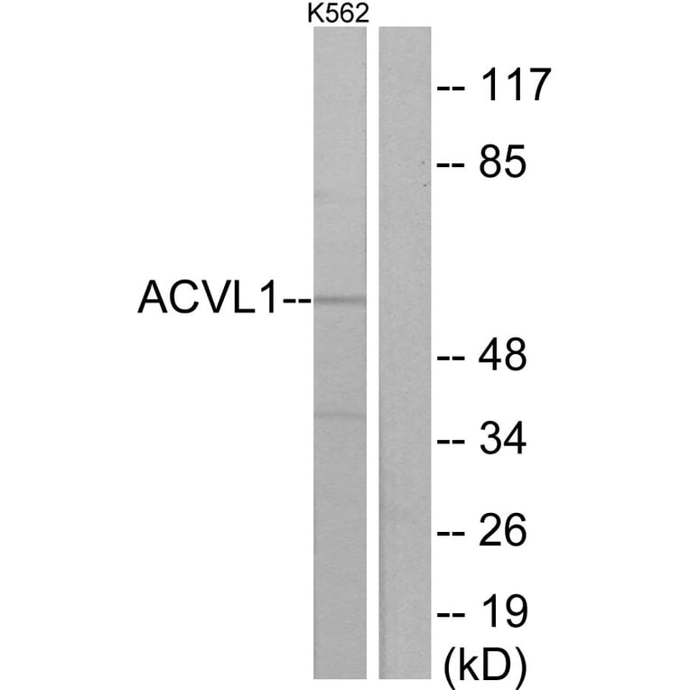 Western Blot - Anti-ACVL1 Antibody (C10579) - Antibodies.com