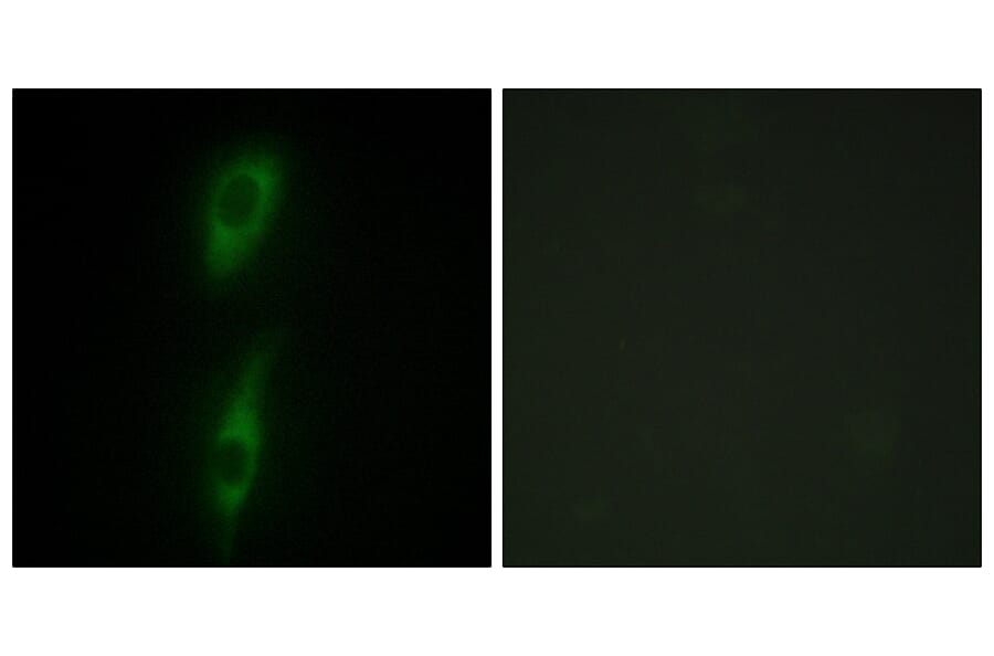 Immunofluorescence - Anti-ACVL1 Antibody (C10579) - Antibodies.com