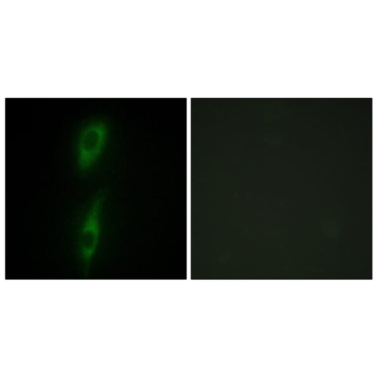 Immunofluorescence - Anti-ACVL1 Antibody (C10579) - Antibodies.com