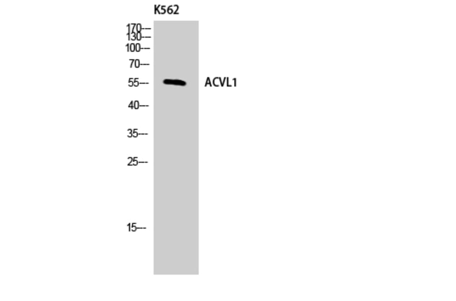 Western Blot - Anti-ACVL1 Antibody (C10579) - Antibodies.com