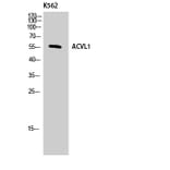 Western Blot - Anti-ACVL1 Antibody (C10579) - Antibodies.com