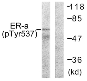 Western Blot - Anti-Estrogen Receptor-alpha (phospho Tyr537) Antibody (A0476) - Antibodies.com