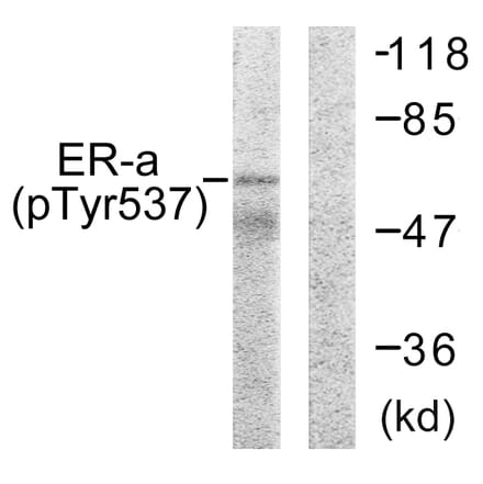 Western Blot - Anti-Estrogen Receptor-alpha (phospho Tyr537) Antibody (A0476) - Antibodies.com