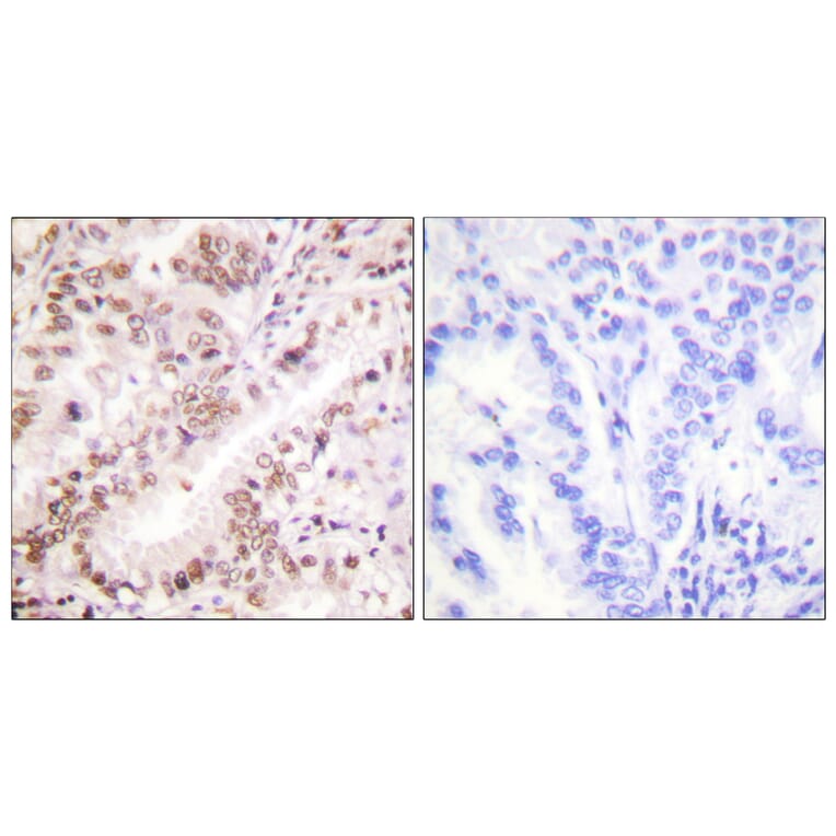 Immunohistochemistry - Anti-Estrogen Receptor-alpha (phospho Tyr537) Antibody (A0476) - Antibodies.com