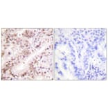 Immunohistochemistry - Anti-Estrogen Receptor-alpha (phospho Tyr537) Antibody (A0476) - Antibodies.com