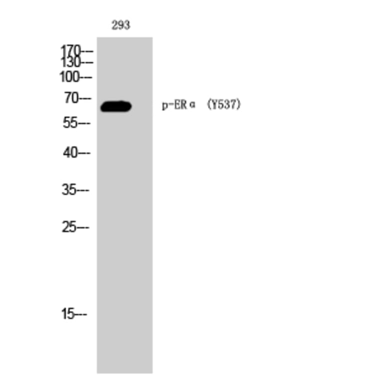 Western Blot - Anti-Estrogen Receptor-alpha (phospho Tyr537) Antibody (A0476) - Antibodies.com