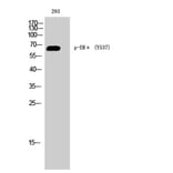 Western Blot - Anti-Estrogen Receptor-alpha (phospho Tyr537) Antibody (A0476) - Antibodies.com