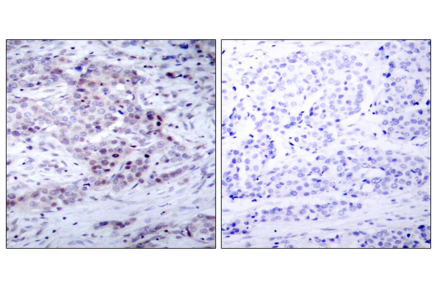 Immunohistochemistry - Anti-NF kappa B p100 / p52 (phospho Ser869) Antibody (A7165) - Antibodies.com