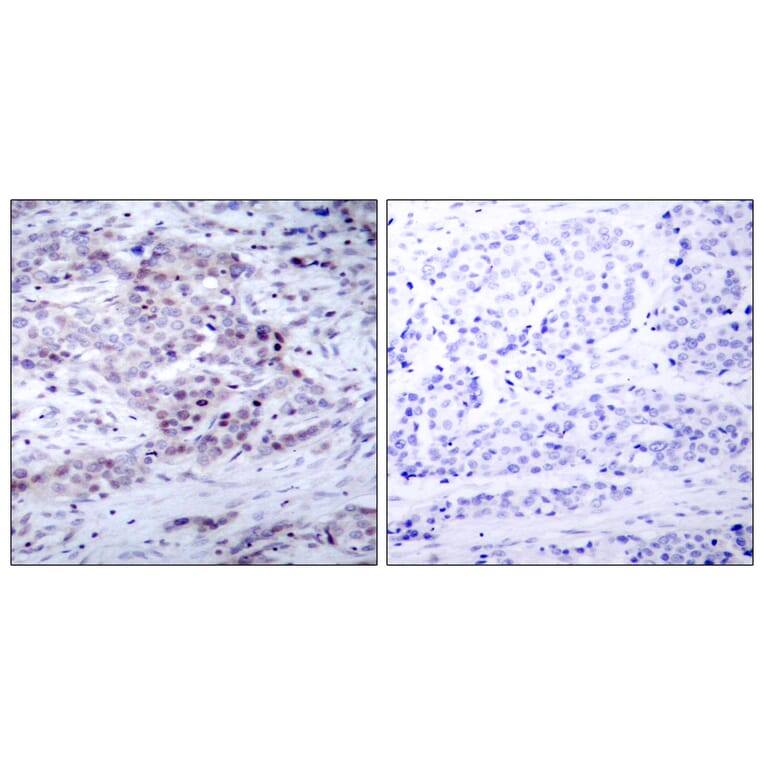 Immunohistochemistry - Anti-NF kappa B p100 / p52 (phospho Ser869) Antibody (A7165) - Antibodies.com