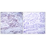 Immunohistochemistry - Anti-NF kappa B p100 / p52 (phospho Ser869) Antibody (A7165) - Antibodies.com