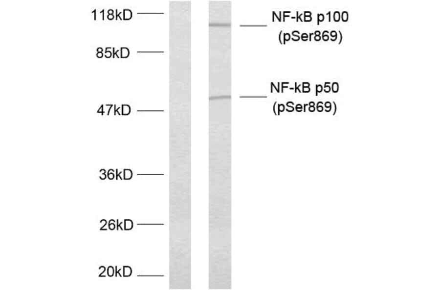 Western Blot - Anti-NF kappa B p100 / p52 (phospho Ser869) Antibody (A7165) - Antibodies.com