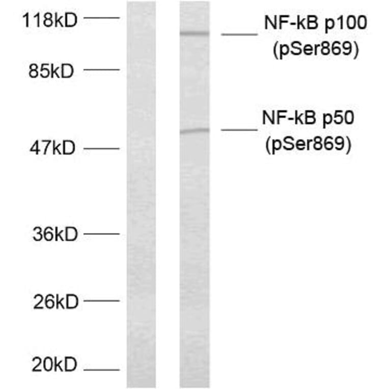 Western Blot - Anti-NF kappa B p100 / p52 (phospho Ser869) Antibody (A7165) - Antibodies.com