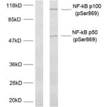 Western Blot - Anti-NF kappa B p100 / p52 (phospho Ser869) Antibody (A7165) - Antibodies.com
