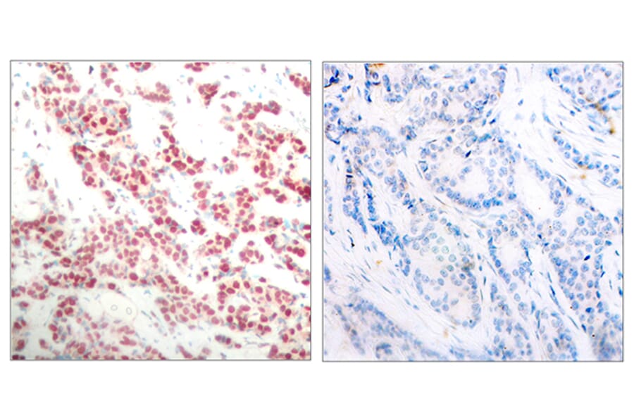Immunohistochemistry - Anti-NF kappa B p100 / p52 (phospho Ser865) Antibody (A7164) - Antibodies.com