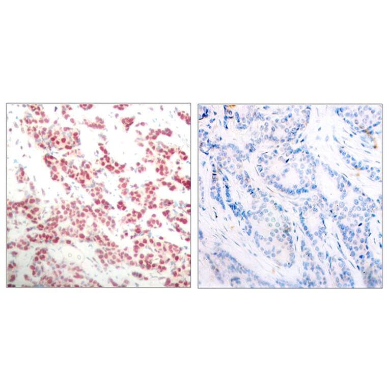 Immunohistochemistry - Anti-NF kappa B p100 / p52 (phospho Ser865) Antibody (A7164) - Antibodies.com