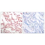 Immunohistochemistry - Anti-NF kappa B p100 / p52 (phospho Ser865) Antibody (A7164) - Antibodies.com