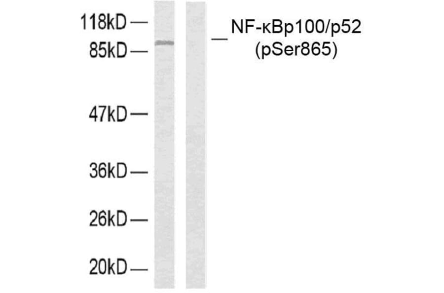 Western Blot - Anti-NF kappa B p100 / p52 (phospho Ser865) Antibody (A7164) - Antibodies.com