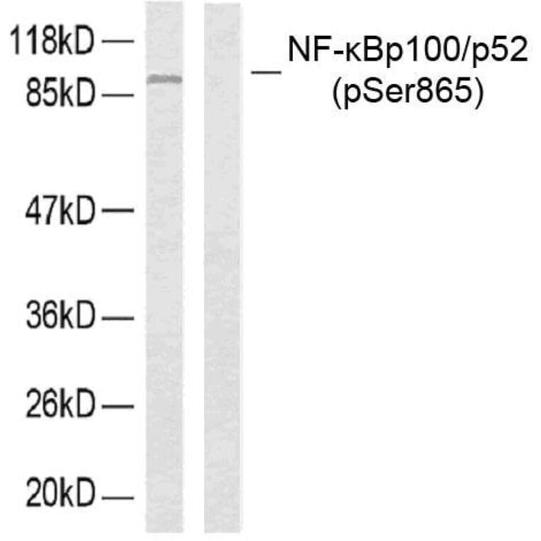 Western Blot - Anti-NF kappa B p100 / p52 (phospho Ser865) Antibody (A7164) - Antibodies.com