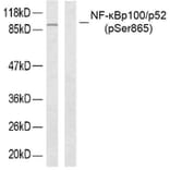 Western Blot - Anti-NF kappa B p100 / p52 (phospho Ser865) Antibody (A7164) - Antibodies.com