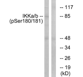 Western Blot - Anti-IKK alpha + beta (phospho Ser180 + Ser181) Antibody (A0440) - Antibodies.com