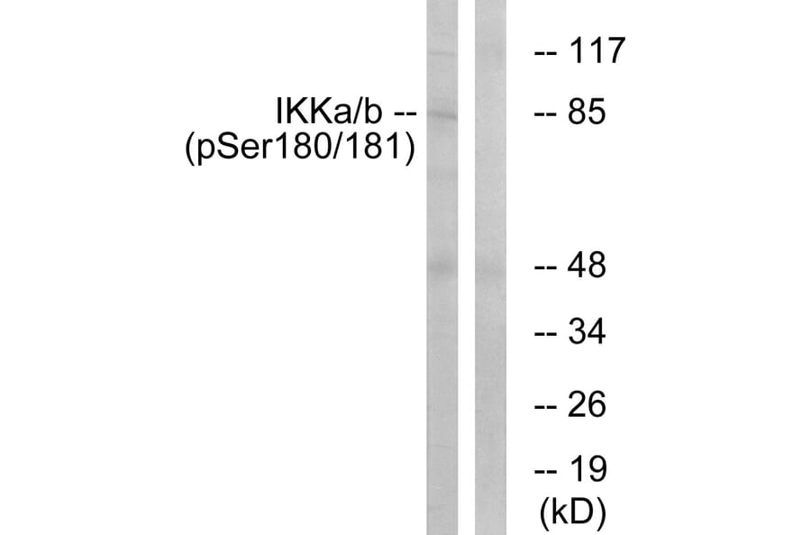 Western Blot - Anti-IKK alpha + beta (phospho Ser180 + Ser181) Antibody (A0440) - Antibodies.com