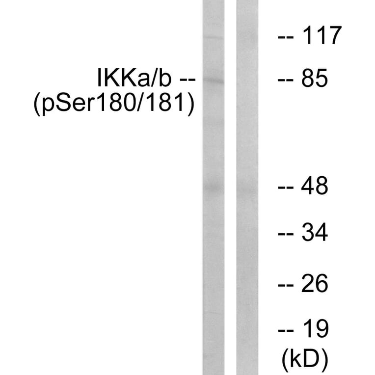 Western Blot - Anti-IKK alpha + beta (phospho Ser180 + Ser181) Antibody (A0440) - Antibodies.com